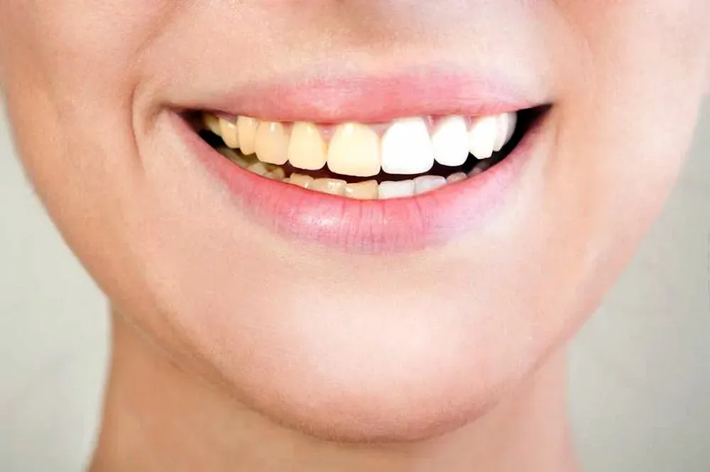 Esta bebida muy consumida mancha m&aacute;s los dientes que el caf&eacute;