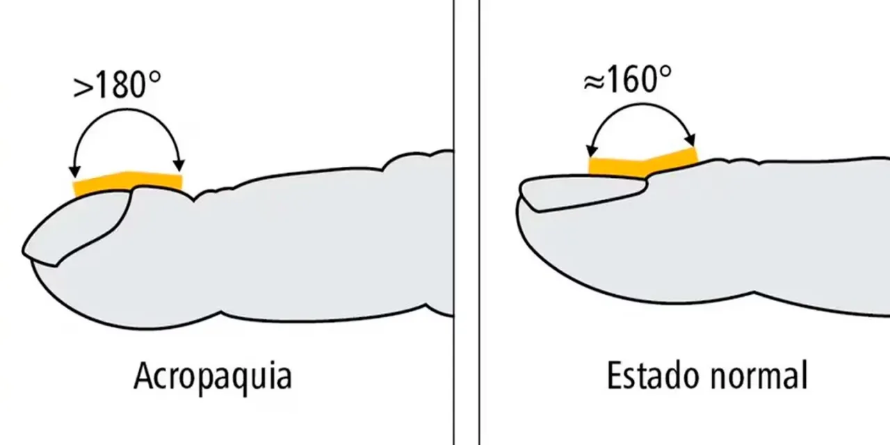 9 de Julio, Día de la Independencia en Argentina