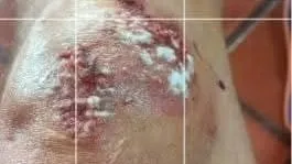 Advierten que masticar chicle bajo estrés podría ser contraproducente