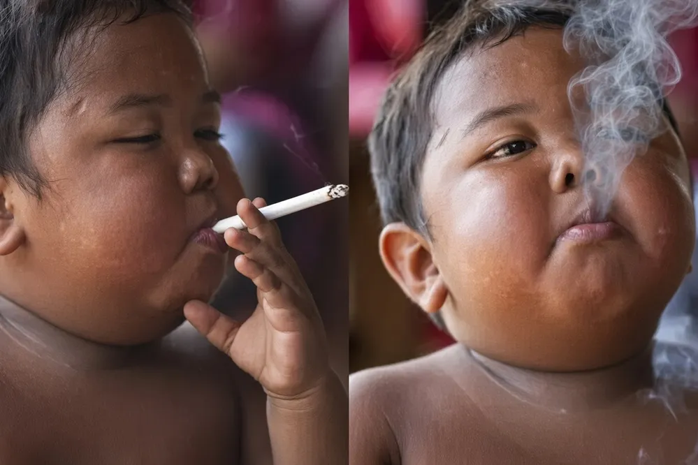 Así está hoy el bebé que se hizo viral por fumar con solo 2 años