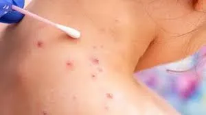 AVISO DE ALERTA POR VIENTOS FURTES