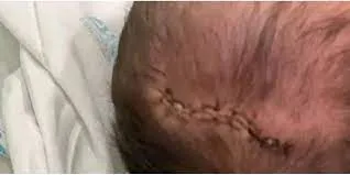 Brenda Asnicar subió una foto sin corpiño a Instagram y se arrepintió