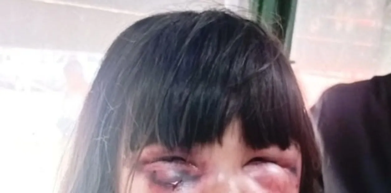 Brutal: golpeó a su hijo y lo mandó al Hospital de Niños