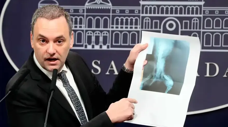 Brutal golpiza para robarle: Le dieron con un hierro en la cabeza
