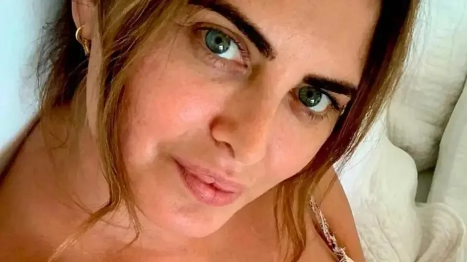 Dile adiós a las ojeras