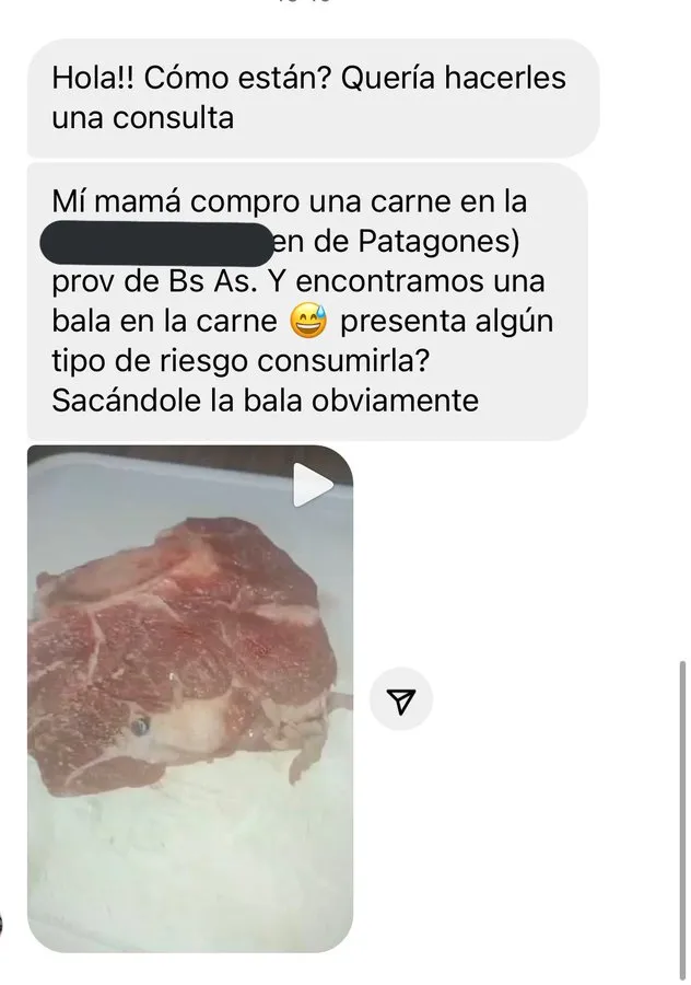 El único país que autoriza venta de órganos que promueve Milei: ofrecen un riñón por 4 mil dólares
