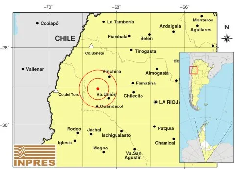 Gemelas unidas por el estómago, y que comparten cordón umbilical, son separadas con solo un día de vida