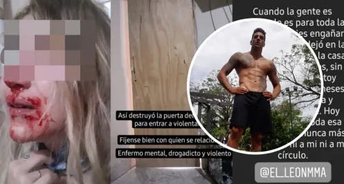 Guillermina Valdés rompió el silencio y contó cómo es el estado de salud de Soledad Aquino, la ex de Tinelli