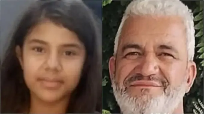 Hígado a la Veneziana