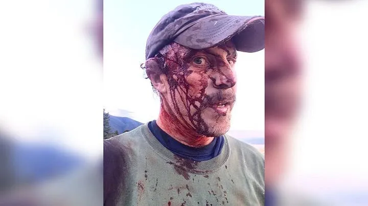 Hombre con Covid fue caminando hasta el hospital porque no había ambulancia y murió en la puerta