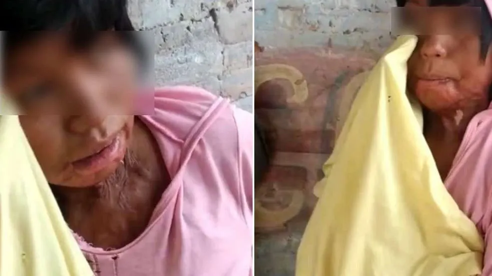 Imágenes de los intoxicados por la cocaína adulterada