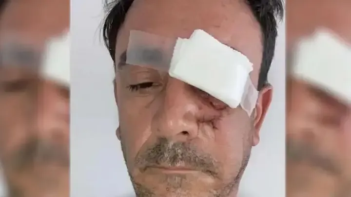 Imágenes sensibles: violento vuelco en Balcozna
