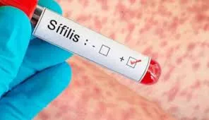 Impactantes imágenes del siniestro vial fatal en La Paz