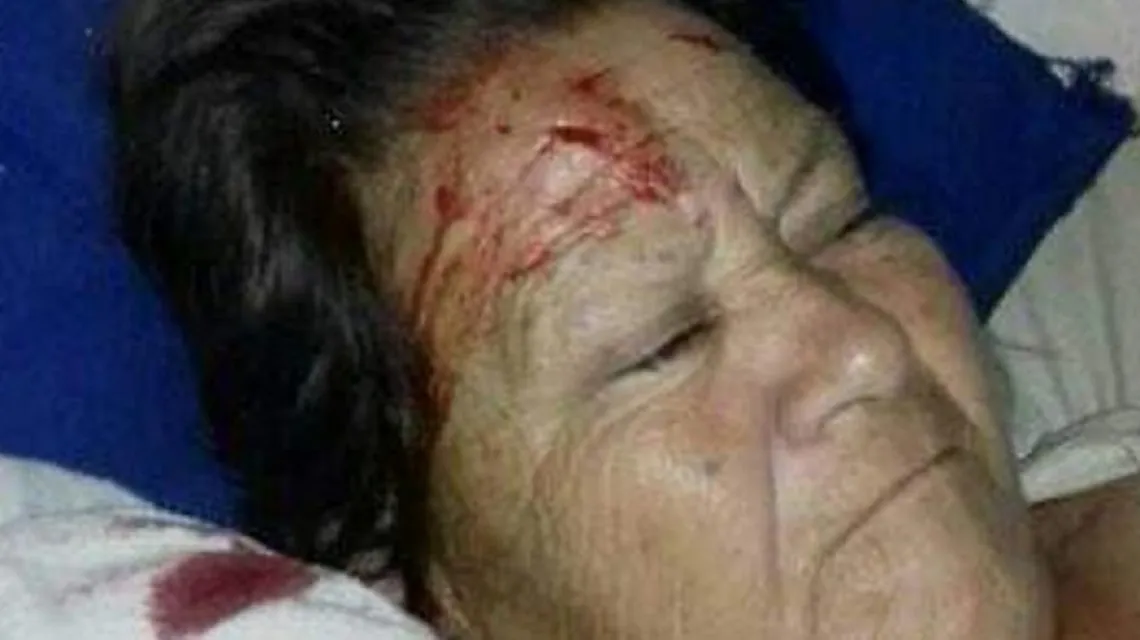 Insólito accidente