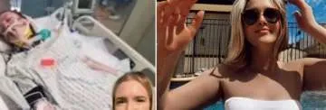Justin Bieber se grabó en un video con media cara paralizada: qué le pasa