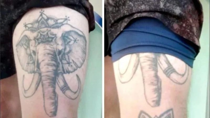 La historia del doctor Ácido, el cardiólogo que desfiguró y mató a su esposa