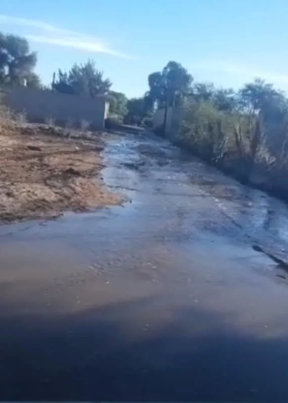 La modelo a la que le amputaron una pierna y siguió desfilando con una prótesis