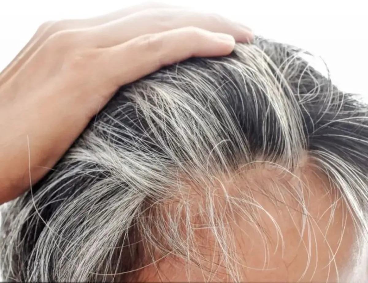Una mano apartando mechones de cabello con canas visibles en la cabeza de una persona.