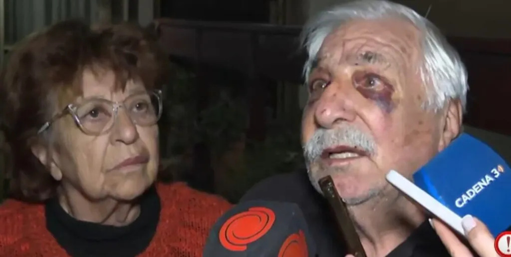 Un hombre con un moreton en el ojo habla frente a microfonos junto a una mujer con anteojos.