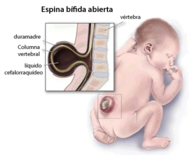 Le dolía la panza, lo llevaron al médico y le encontraron un raro objeto adentro