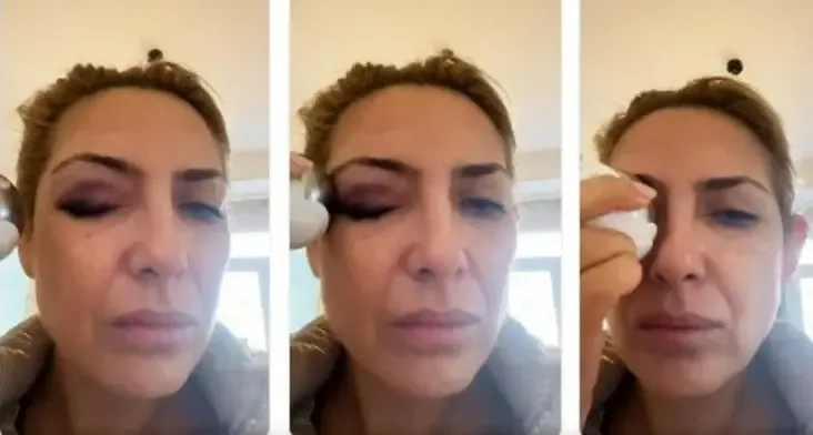 Le robaron $200.000