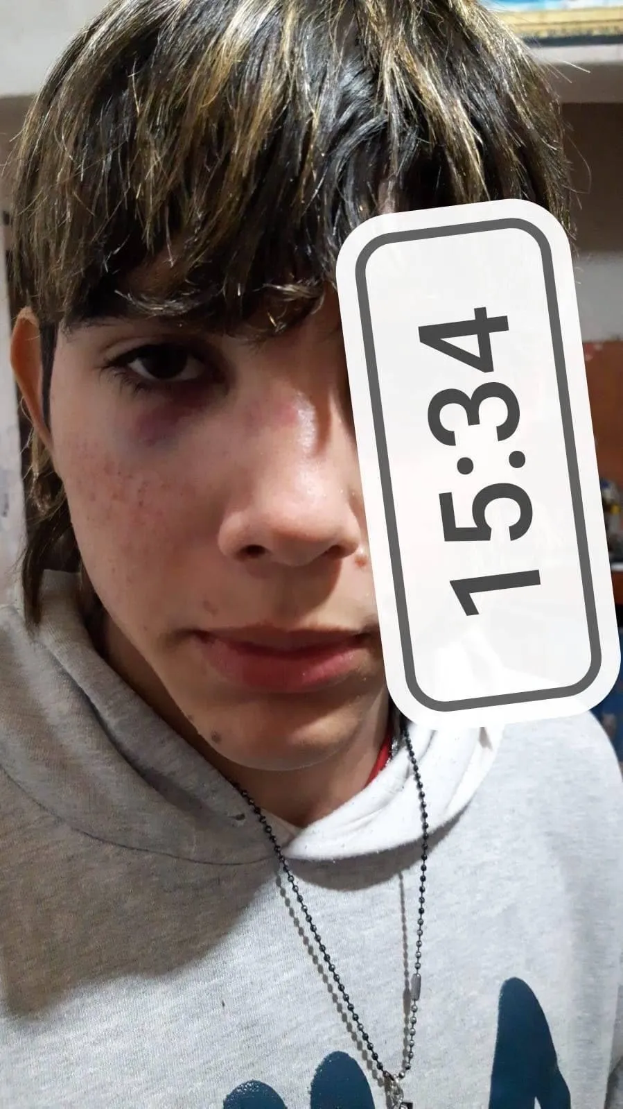 Mató a su hijo de 10 años con autismo y se suicidó