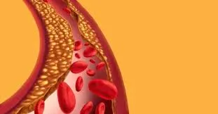 Medidas de prevención contra la Salmonella