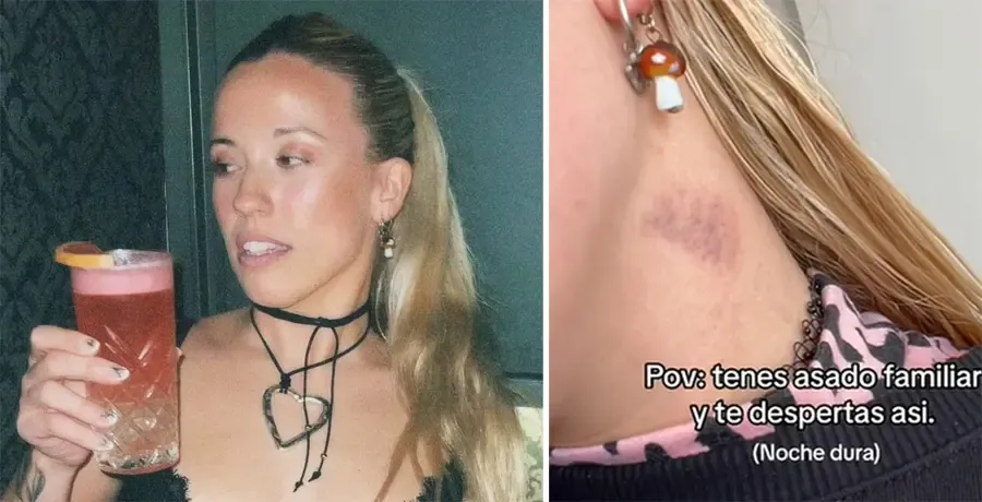Motociclista chocó a una adolescente cuando cruzaba la calzada