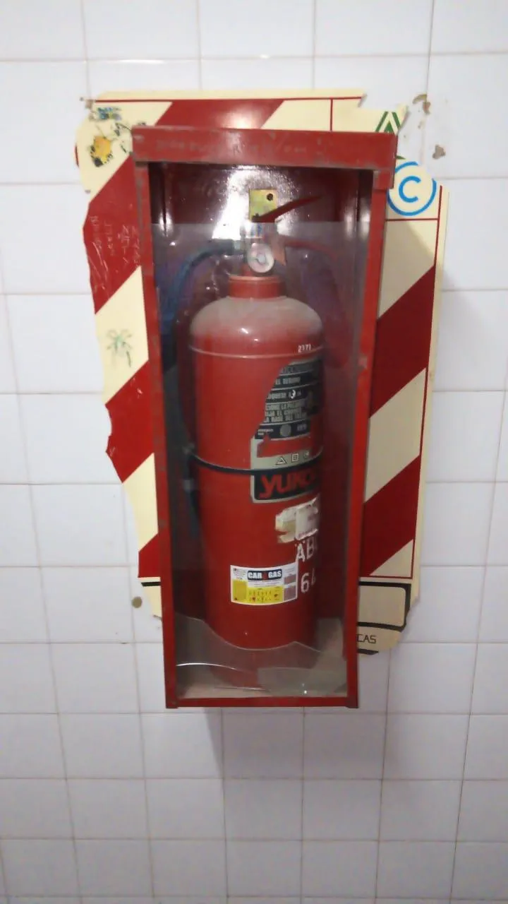 Mujer pensó que tenía infección urinaria pero le descubrieron un vaso en su vejiga