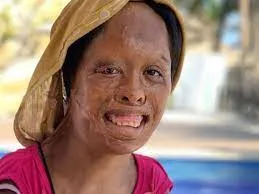 Murió un paciente con hongo negro, blanco y amarillo que también tenía coronavirus