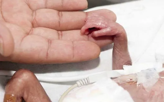 Nació un ternero con dos cabezas: “Tiene cuatro ojos y dos bocas, pero el resto del cuerpo es normal”
