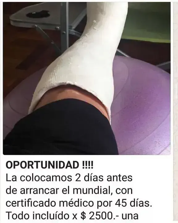 Ofrecen yesos truchos para faltar al trabajo y poder ver a la Selección argentina durante el Mundial