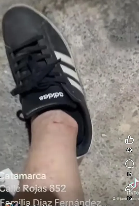 Olvídate de los hongos en tus uñas gracias a este truco casero