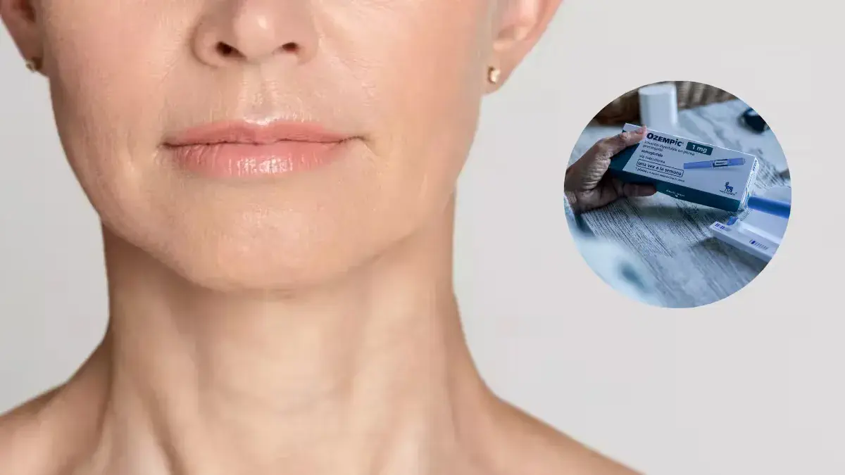 Qué es el “cuello de Ozempic”, el efecto secundario que preocupa a usuarios de medicamentos para adelgazar