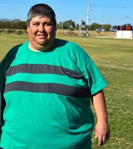 Qué retoques estéticos se hizo Antonela Roccuzzo