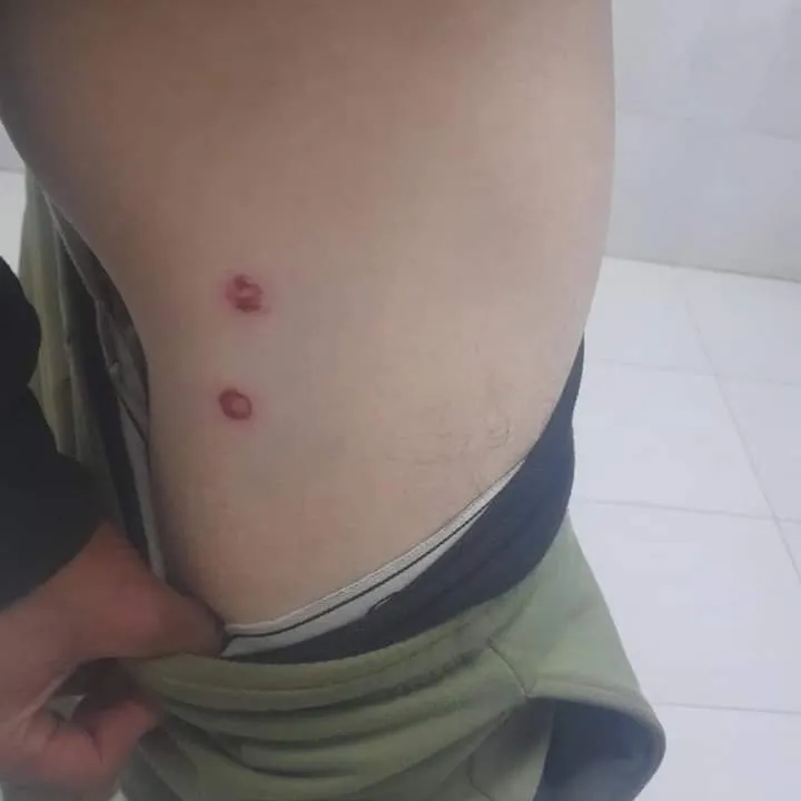 Salió de la calzada y dio varios tumbos