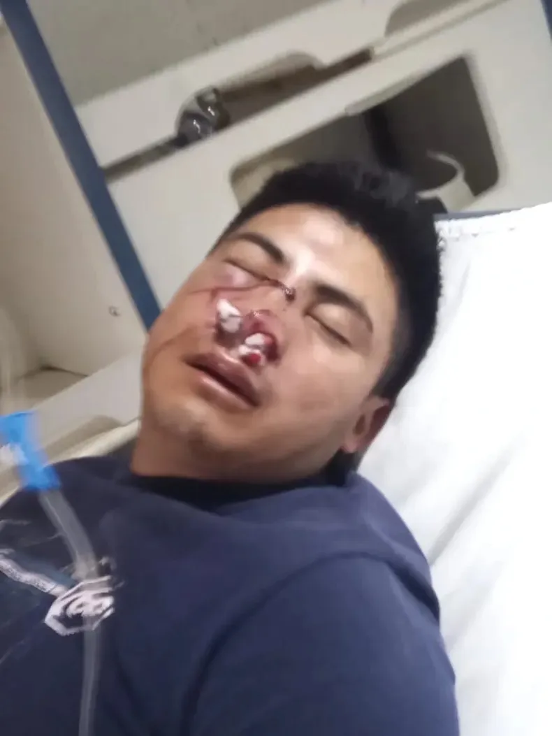 “Se nos murió todo”: fueron a un motel pero algo en el lugar los impactó y apagó la llama