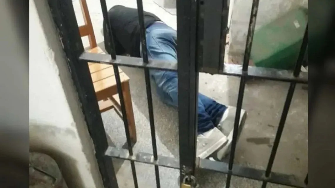 Tiene una marca de nacimiento en la cara y sufrió bullying