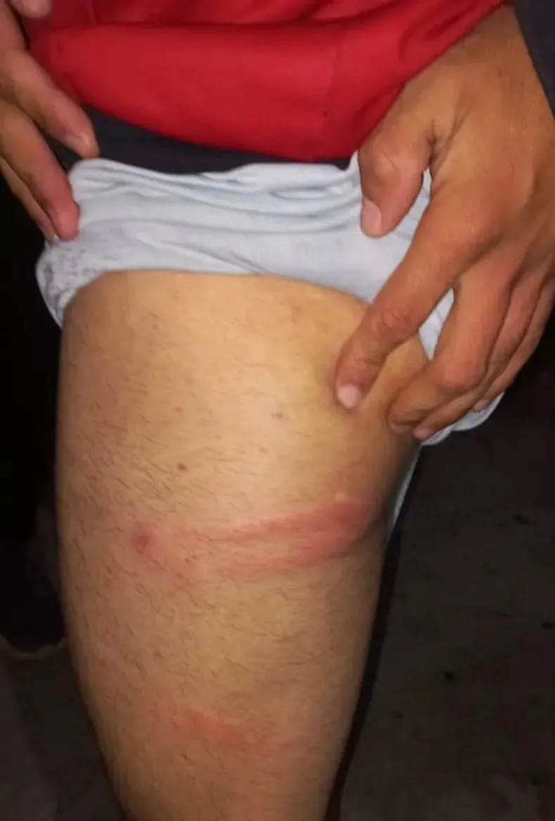 Un ciclista derrapó en la Quebrada de Moreira