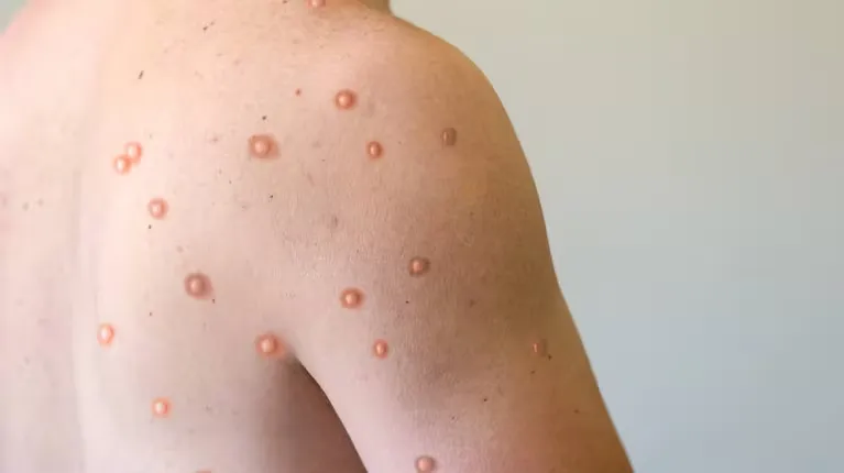 Un fotógrafo argentino que viajaba por el mundo en bicicleta murió atropellado en Nigeria