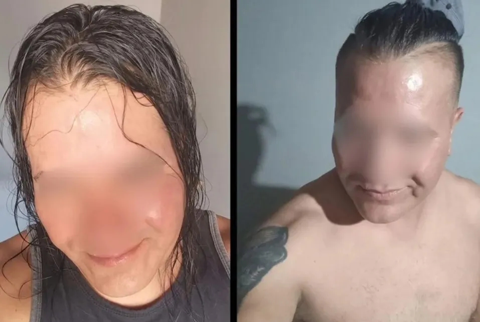 Un joven fue apuñalado