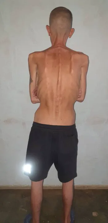 Una persona delgada de espaldas parada frente a una pared clara con los brazos cruzados y bermuda negra.