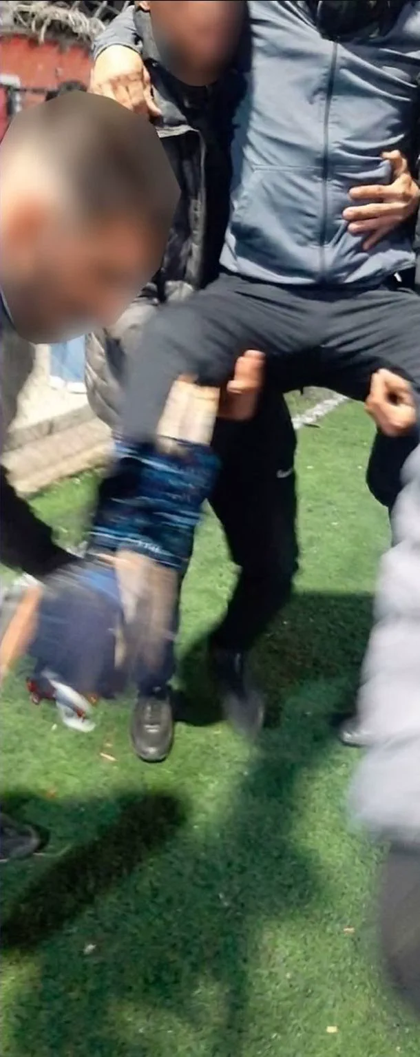 Dos personas llevan en andas por el pasto a una persona que tiene colocada una protesis en la pierna.