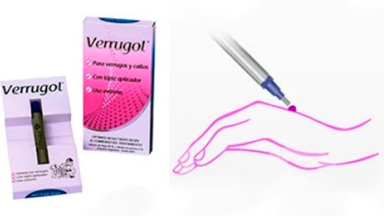 Caja y aplicador de Verrugol junto a la ilustración de una mano donde se aplica el producto.