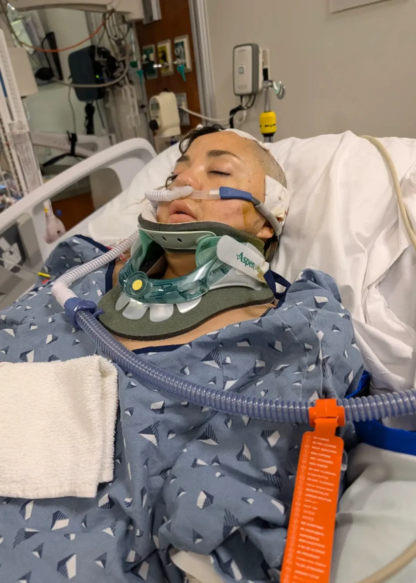 Una mujer yace internada en una cama de hospital con cuello ortopedico y asistencia respiratoria.