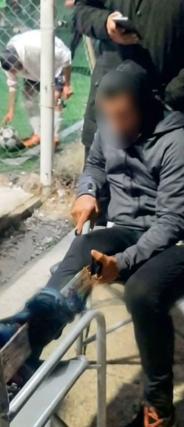 Una persona sentada al costado de una cancha de futbol sostiene una pierna ortopedica con la mano.