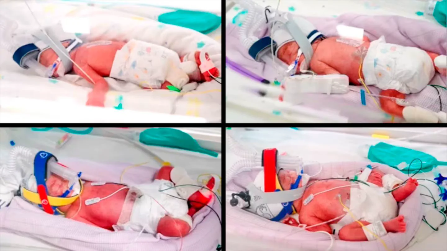 Cuatro tomas de bebés recién nacidos con asistencia respiratoria dentro de incubadoras.