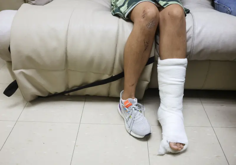 Una persona sentada en un sillón muestra una pierna vendada con yeso y la otra con raspones y zapatilla deportiva.
