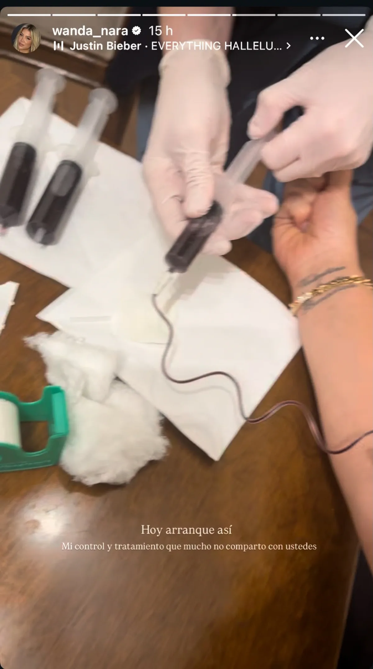 Una persona con guantes extrae sangre con una jeringa del brazo de otra persona.