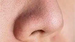 La mascarilla casera que elimina los puntos negros